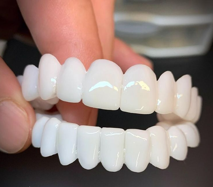 Adjustable Whitening Fake Invisible Holeless Braces